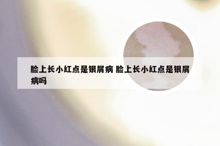 脸上长小红点是银屑病 脸上长小红点是银屑病吗