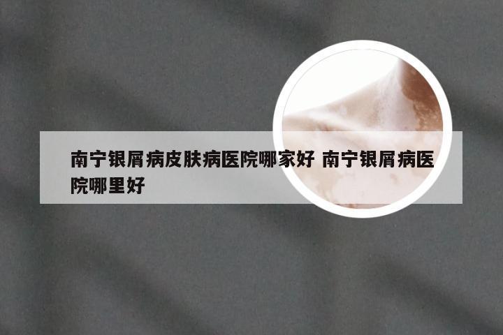 南宁银屑病皮肤病医院哪家好 南宁银屑病医院哪里好
