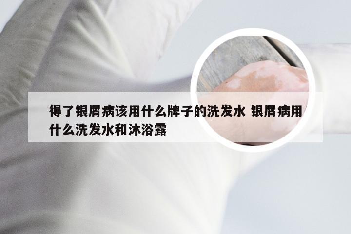 得了银屑病该用什么牌子的洗发水 银屑病用什么洗发水和沐浴露