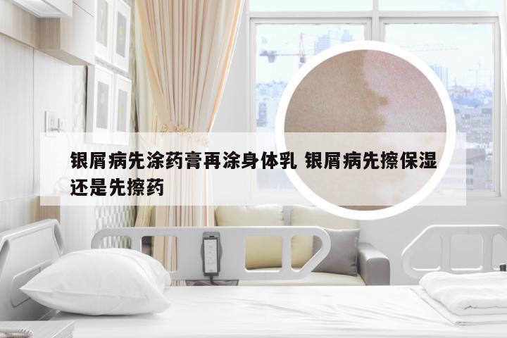 银屑病先涂药膏再涂身体乳 银屑病先擦保湿还是先擦药
