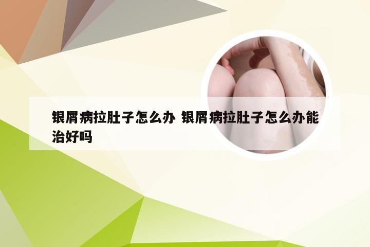 银屑病拉肚子怎么办 银屑病拉肚子怎么办能治好吗