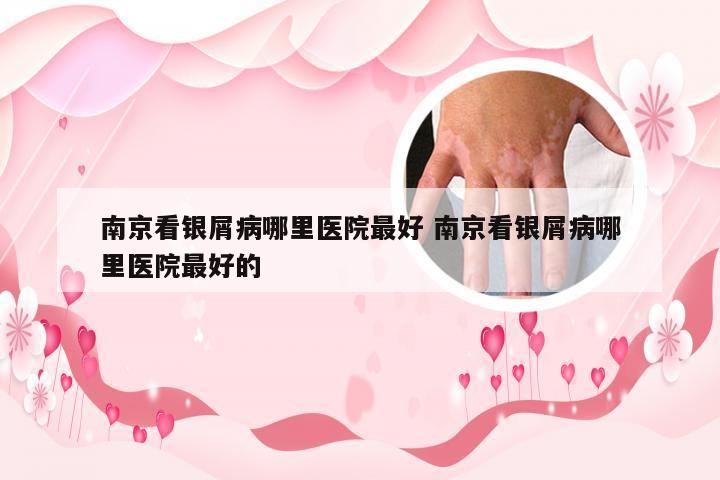 南京看银屑病哪里医院最好 南京看银屑病哪里医院最好的