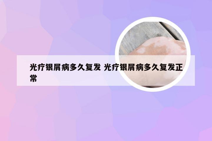 光疗银屑病多久复发 光疗银屑病多久复发正常