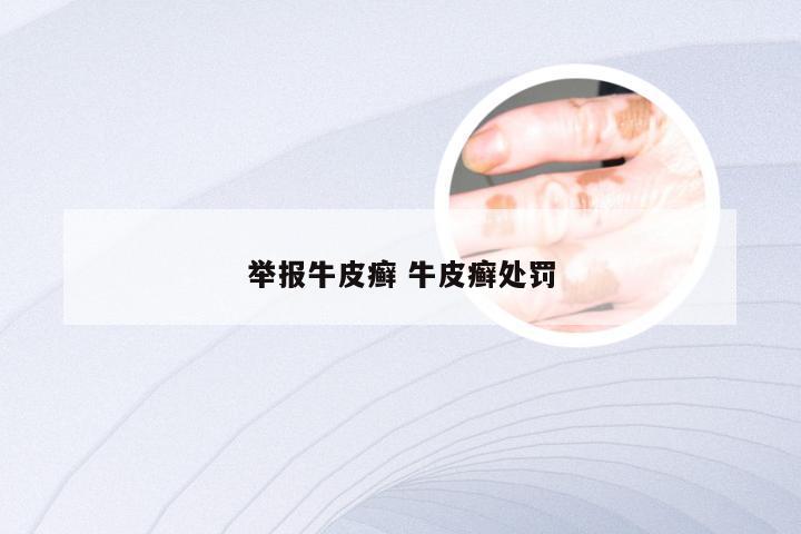 举报牛皮癣 牛皮癣处罚