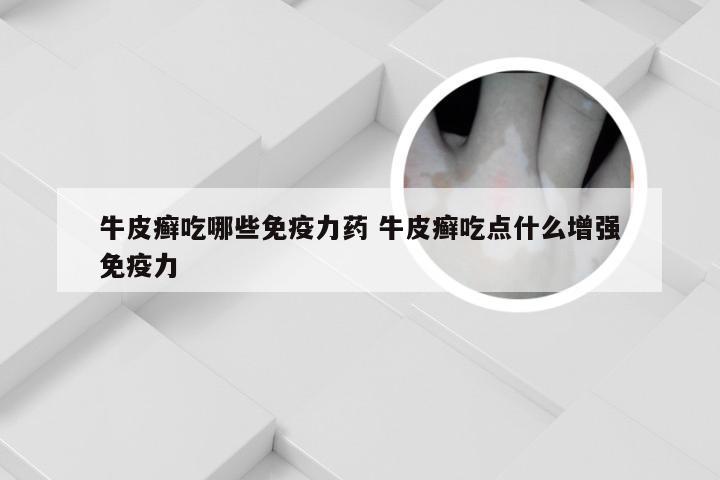 牛皮癣吃哪些免疫力药 牛皮癣吃点什么增强免疫力