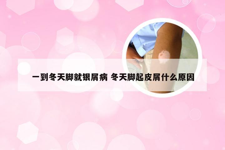 一到冬天脚就银屑病 冬天脚起皮屑什么原因