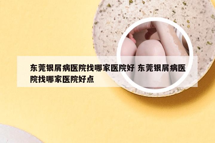 东莞银屑病医院找哪家医院好 东莞银屑病医院找哪家医院好点