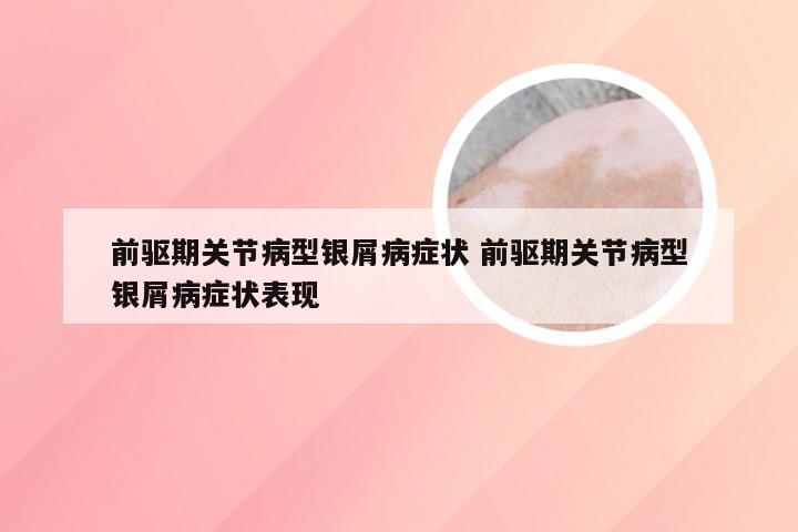 前驱期关节病型银屑病症状 前驱期关节病型银屑病症状表现