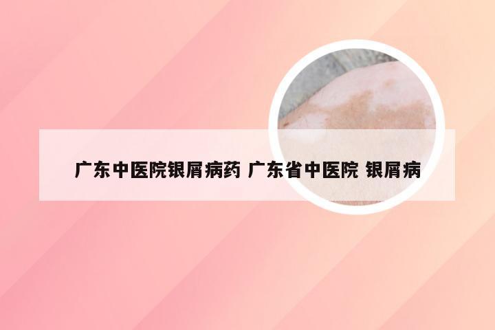 广东中医院银屑病药 广东省中医院 银屑病