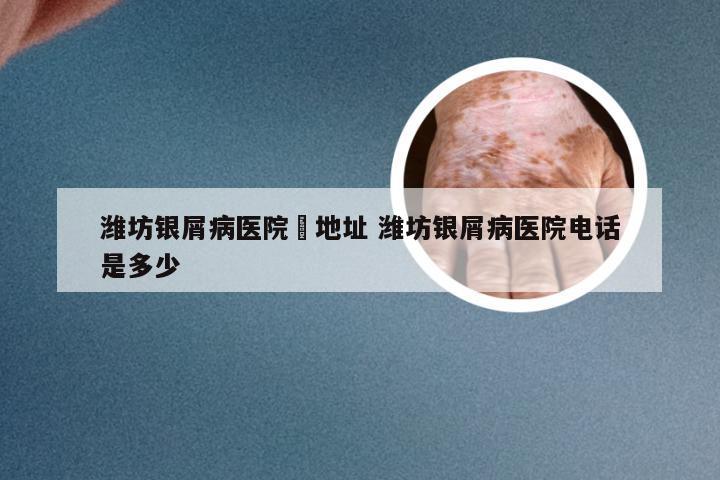 潍坊银屑病医院旳地址 潍坊银屑病医院电话是多少