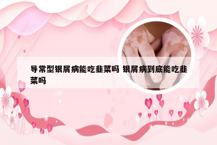 导常型银屑病能吃韭菜吗 银屑病到底能吃韭菜吗