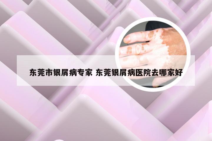 东莞市银屑病专家 东莞银屑病医院去哪家好
