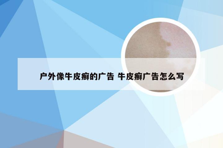 户外像牛皮癣的广告 牛皮癣广告怎么写