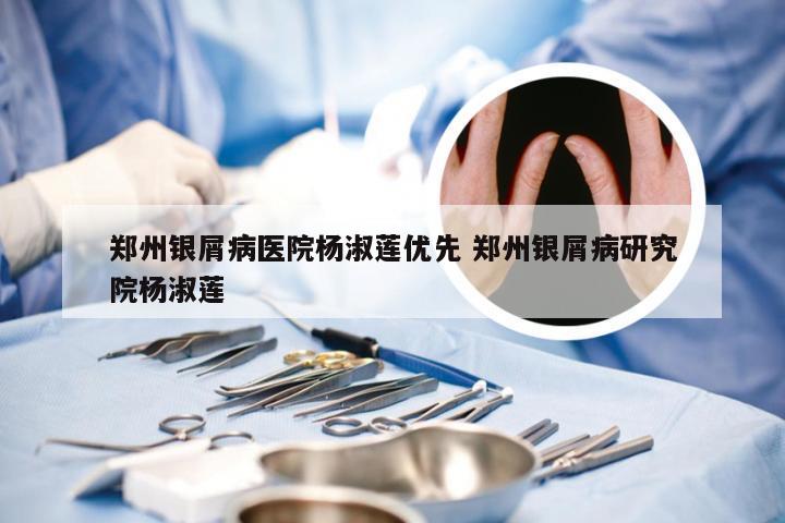 郑州银屑病医院杨淑莲优先 郑州银屑病研究院杨淑莲