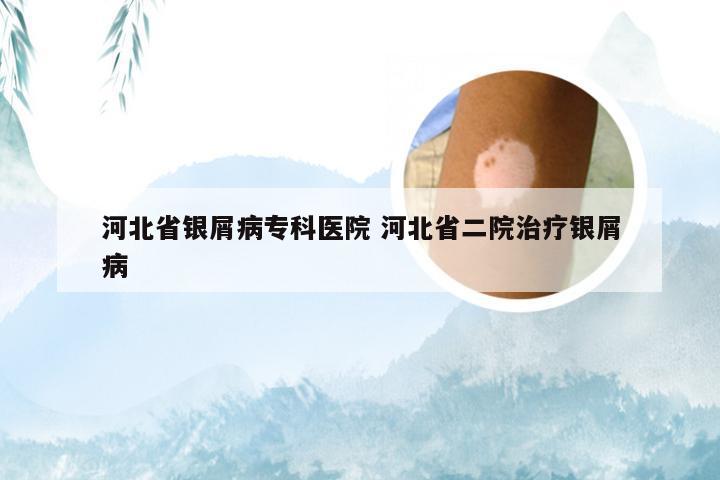 河北省银屑病专科医院 河北省二院治疗银屑病