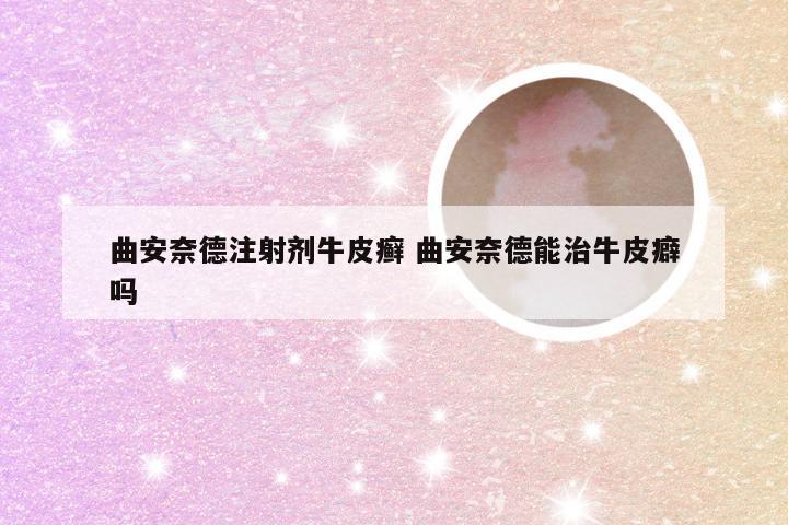曲安奈德注射剂牛皮癣 曲安奈德能治牛皮癖吗