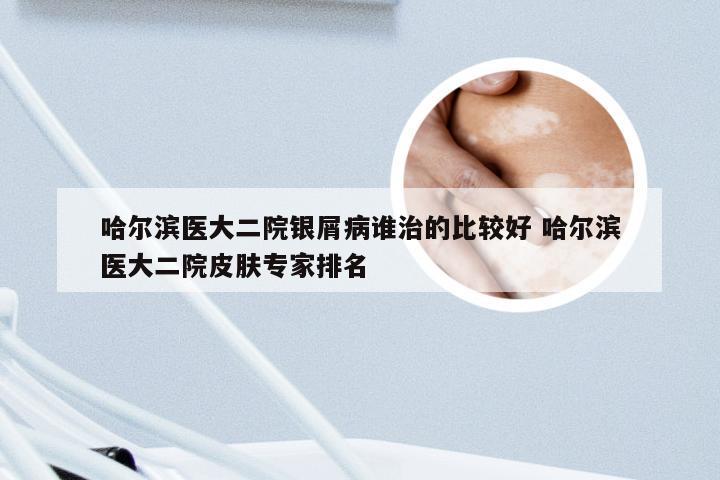 哈尔滨医大二院银屑病谁治的比较好 哈尔滨医大二院皮肤专家排名