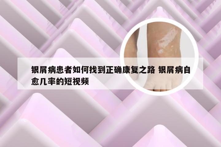 银屑病患者如何找到正确康复之路 银屑病自愈几率的短视频