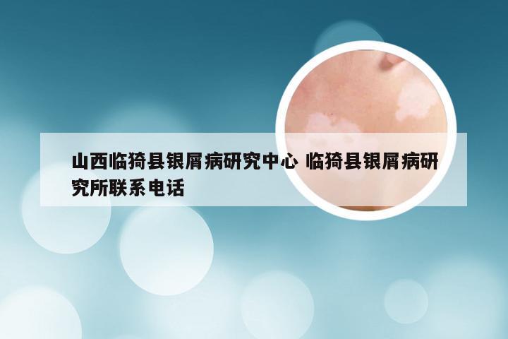 山西临猗县银屑病研究中心 临猗县银屑病研究所联系电话