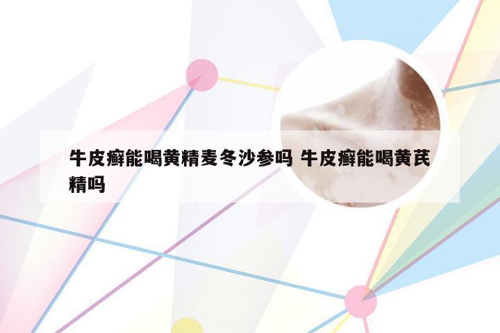 牛皮癣能喝黄精麦冬沙参吗 牛皮癣能喝黄芪精吗