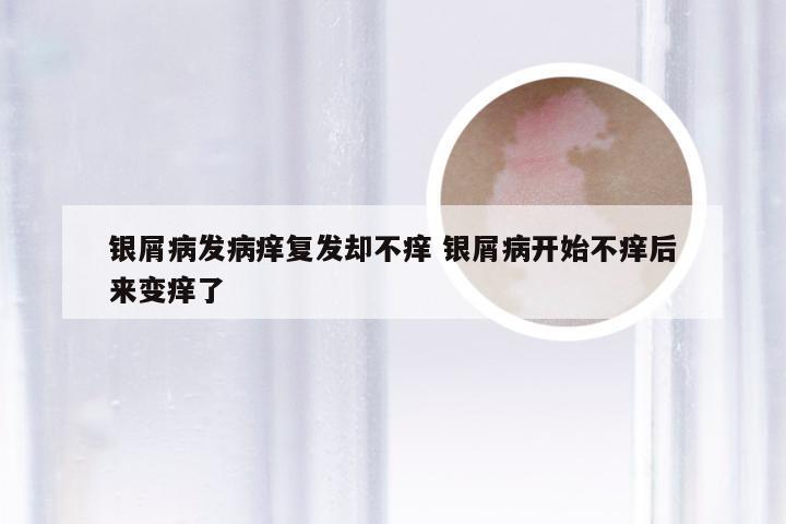 银屑病发病痒复发却不痒 银屑病开始不痒后来变痒了