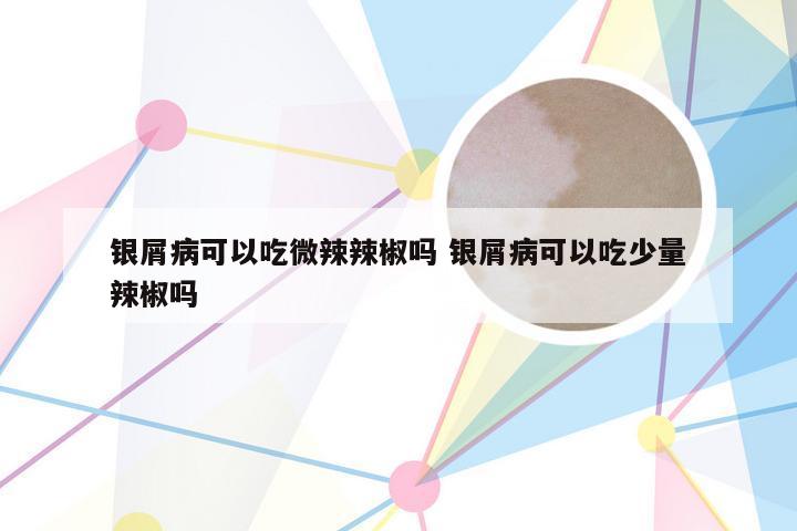 银屑病可以吃微辣辣椒吗 银屑病可以吃少量辣椒吗