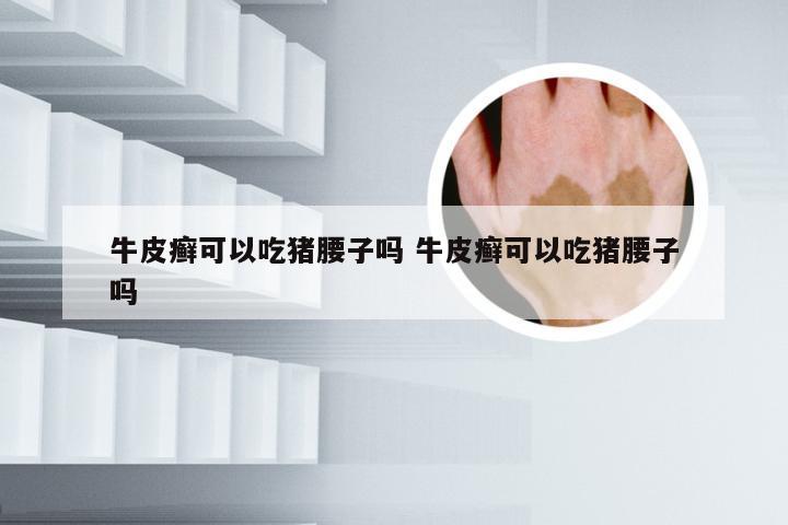牛皮癣可以吃猪腰子吗 牛皮癣可以吃猪腰子吗