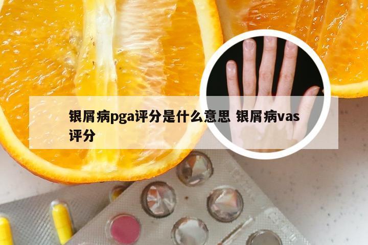 银屑病pga评分是什么意思 银屑病vas评分