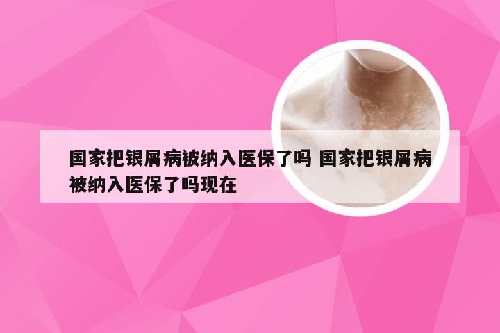 国家把银屑病被纳入医保了吗 国家把银屑病被纳入医保了吗现在