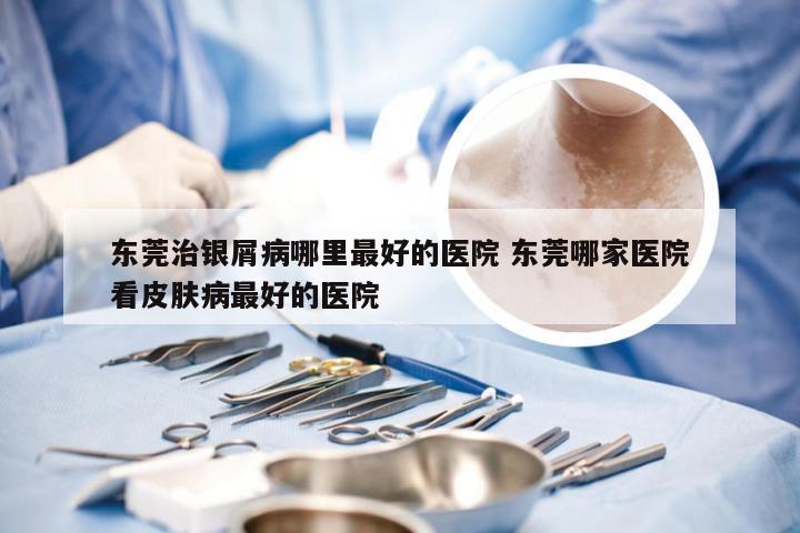 东莞治银屑病哪里最好的医院 东莞哪家医院看皮肤病最好的医院
