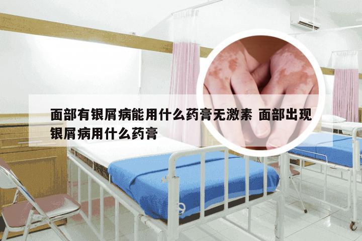面部有银屑病能用什么药膏无激素 面部出现银屑病用什么药膏