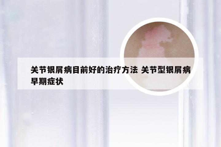关节银屑病目前好的治疗方法 关节型银屑病早期症状