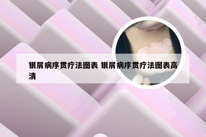 银屑病序贯疗法图表 银屑病序贯疗法图表高清