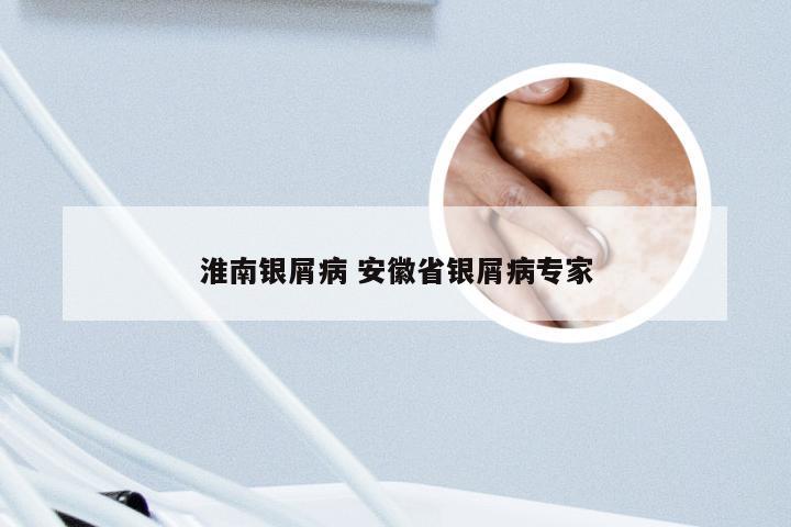 淮南银屑病 安徽省银屑病专家