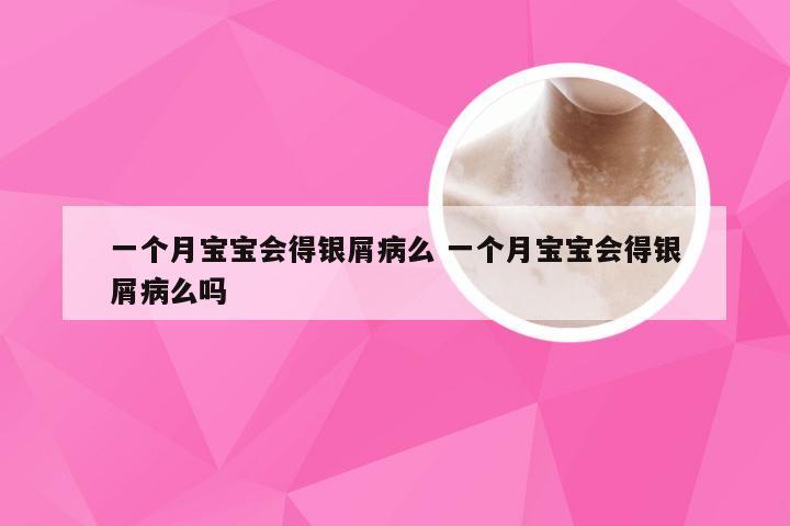 一个月宝宝会得银屑病么 一个月宝宝会得银屑病么吗