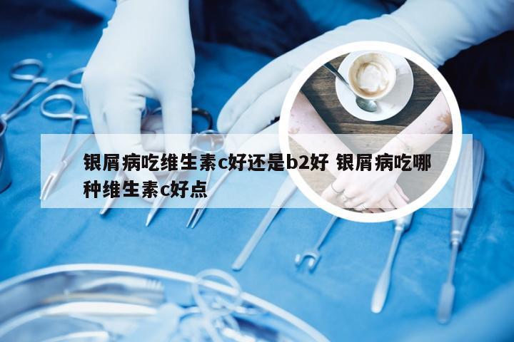银屑病吃维生素c好还是b2好 银屑病吃哪种维生素c好点