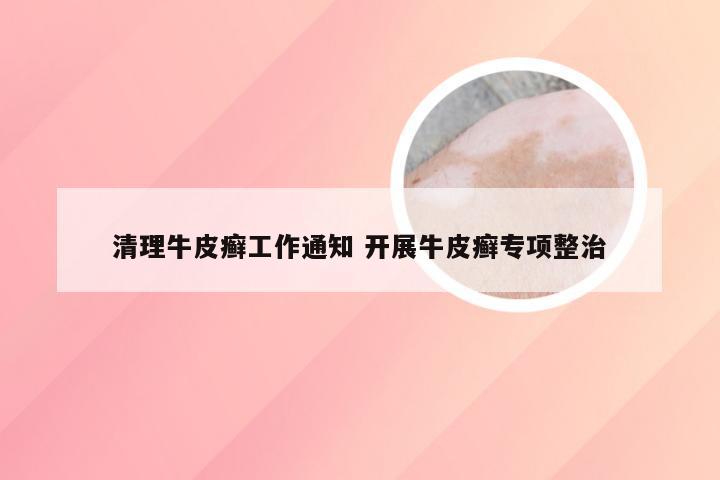 清理牛皮癣工作通知 开展牛皮癣专项整治