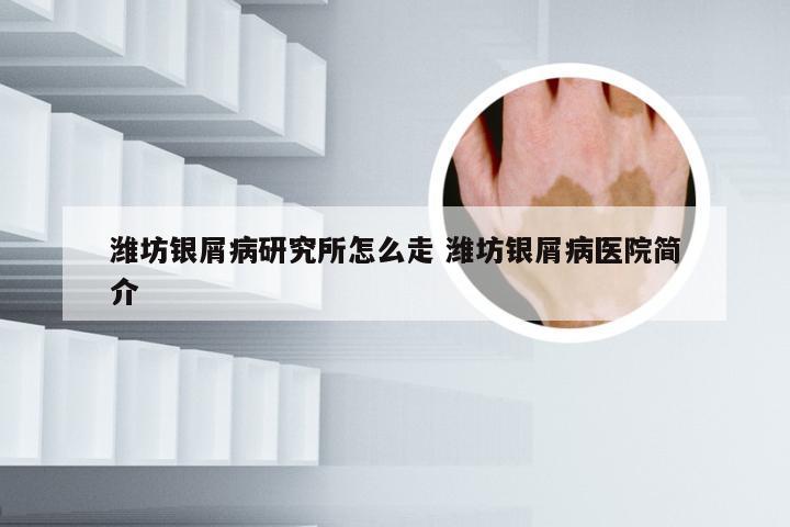 潍坊银屑病研究所怎么走 潍坊银屑病医院简介