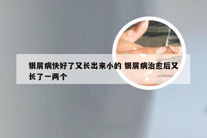 银屑病快好了又长出来小的 银屑病治愈后又长了一两个
