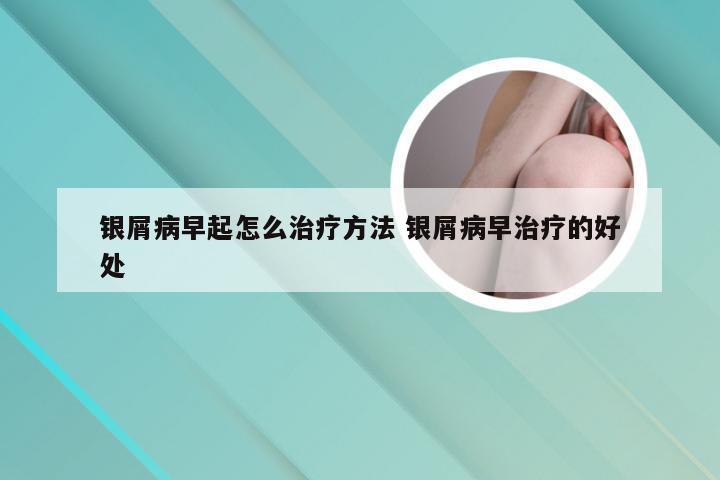 银屑病早起怎么治疗方法 银屑病早治疗的好处