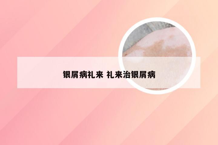 银屑病礼来 礼来治银屑病