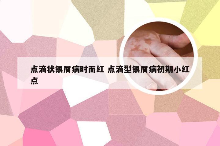 点滴状银屑病时而红 点滴型银屑病初期小红点