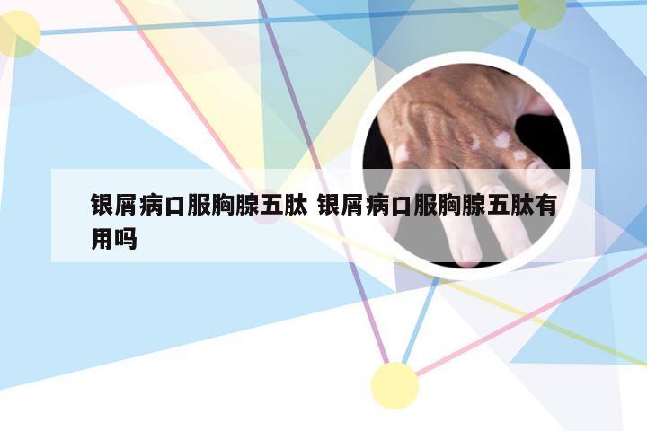 银屑病口服胸腺五肽 银屑病口服胸腺五肽有用吗