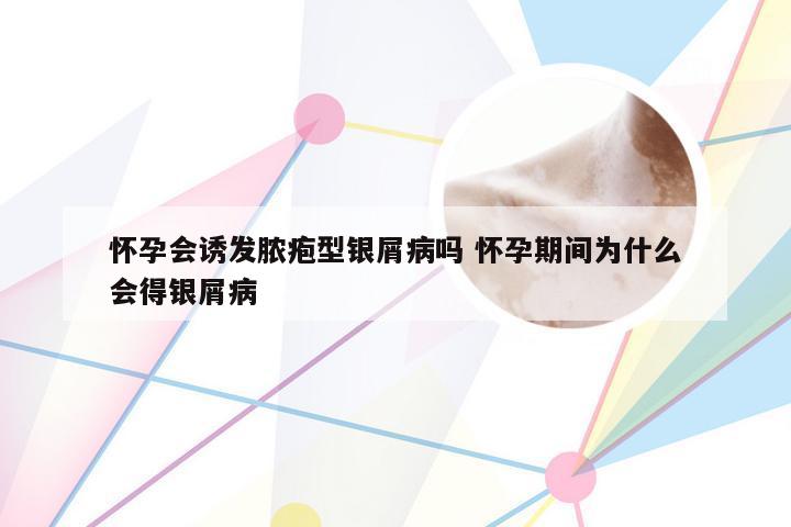 怀孕会诱发脓疱型银屑病吗 怀孕期间为什么会得银屑病