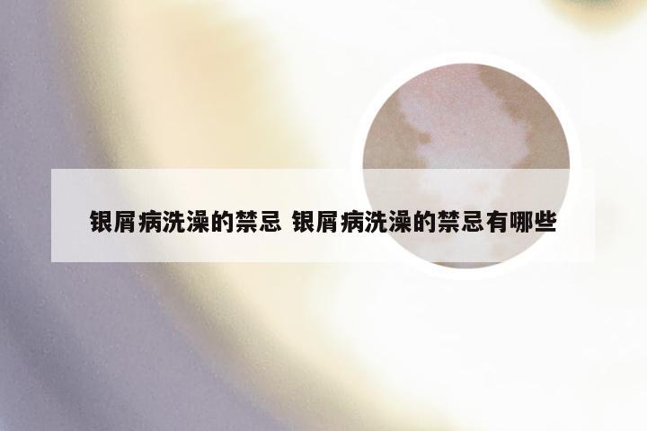 银屑病洗澡的禁忌 银屑病洗澡的禁忌有哪些