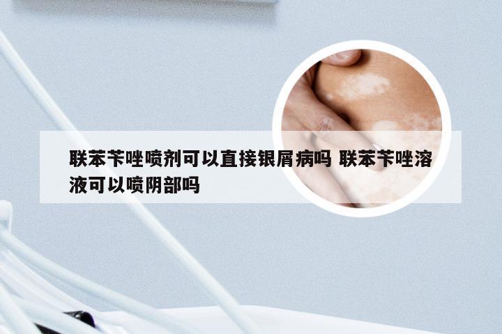 联苯苄唑喷剂可以直接银屑病吗 联苯苄唑溶液可以喷阴部吗
