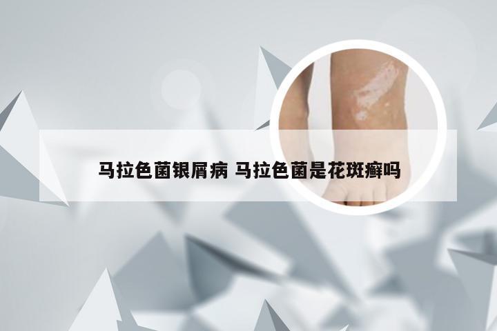 马拉色菌银屑病 马拉色菌是花斑癣吗