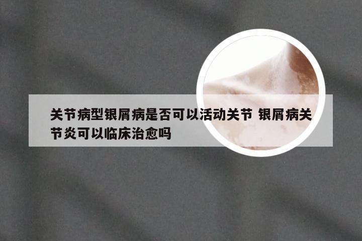 关节病型银屑病是否可以活动关节 银屑病关节炎可以临床治愈吗