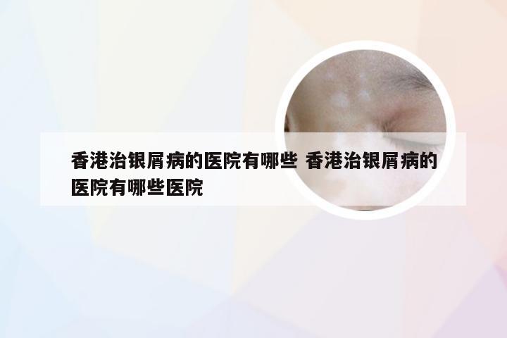 香港治银屑病的医院有哪些 香港治银屑病的医院有哪些医院