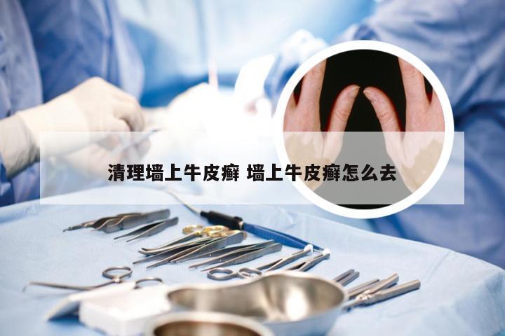 清理墙上牛皮癣 墙上牛皮癣怎么去